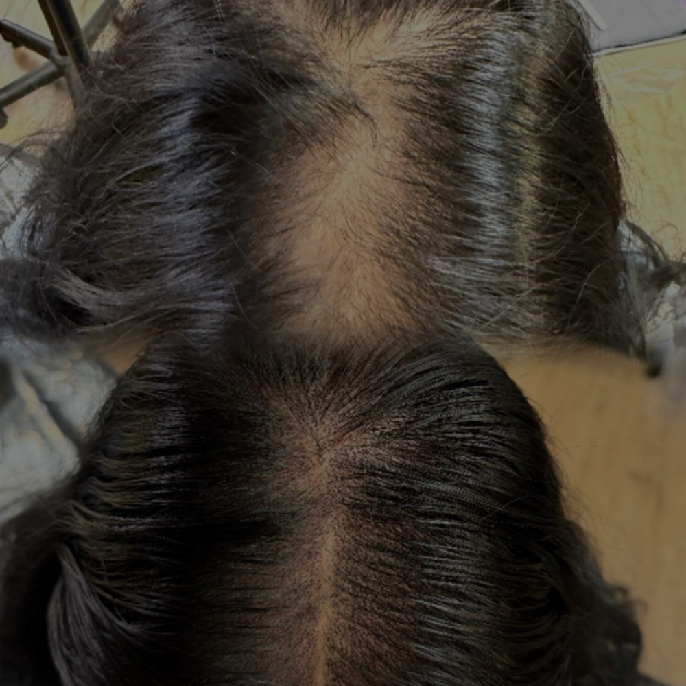 SMP (Scalp Micro Pigmentation) at The Beauty Cove in Keizer, OR
