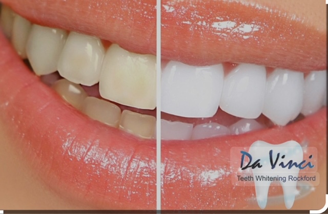 Pure Radiance Package