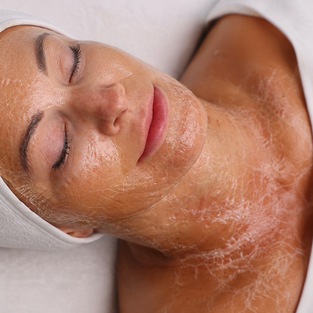 Peptide Lift Facial at Kim’s Aesthetic Studio in Snohomish, WA