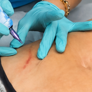 Patch Test at Studio PrimaVera in Roswell, GA