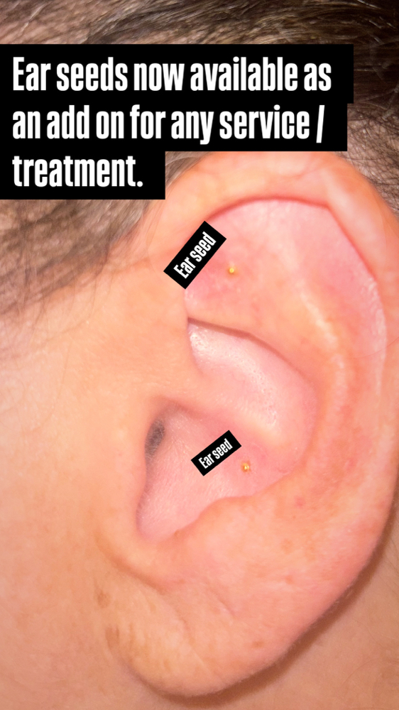 Ear Seeds