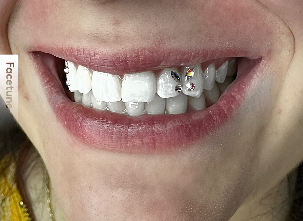 Tooth Gem Butterfly