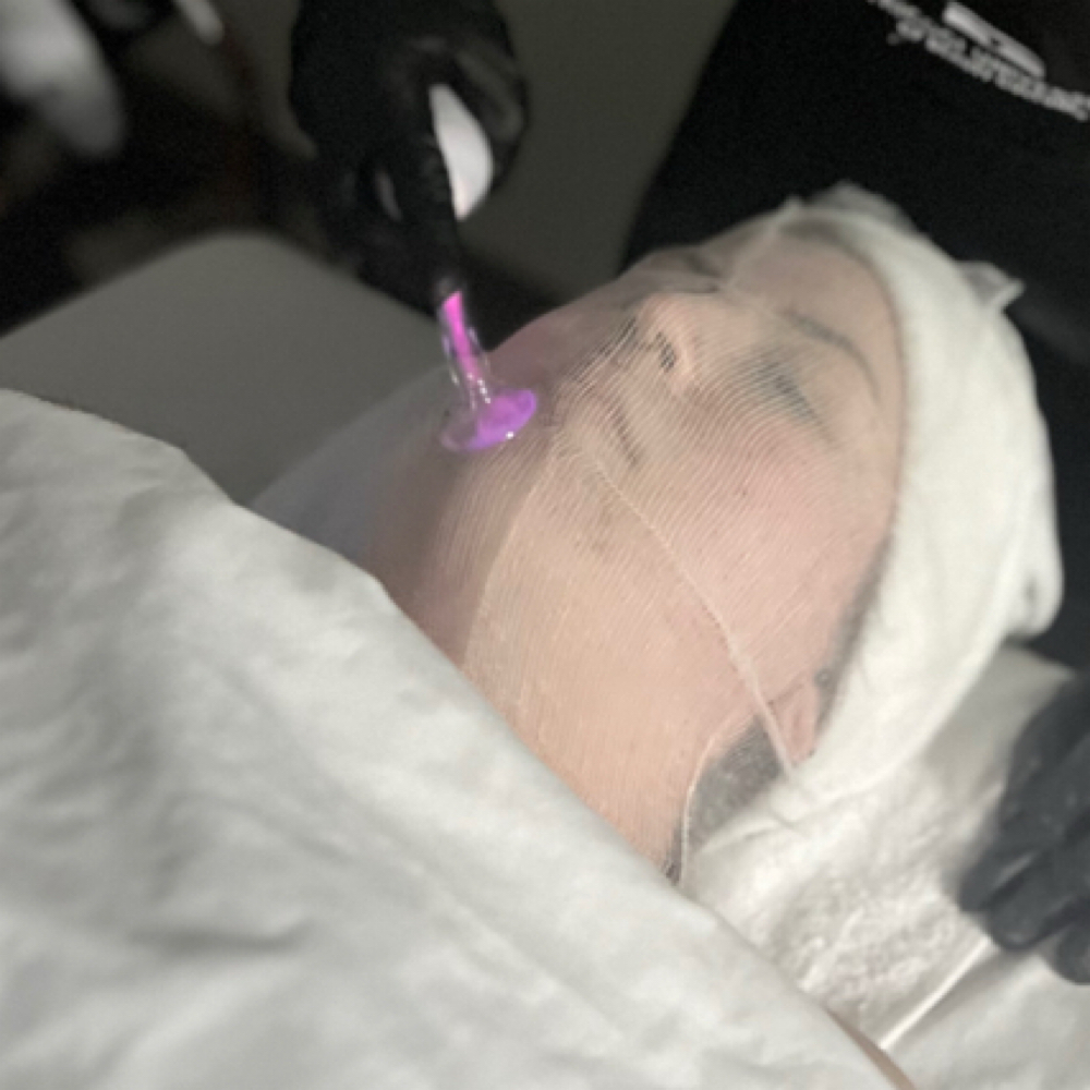 High Frequency- Facial Add-on at Chic Claws in Chicago, IL