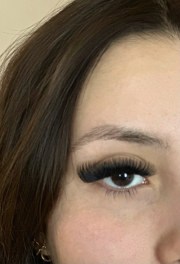 Volume 12-18 Days Fill at Alo Aesthetics in Wichita, KS