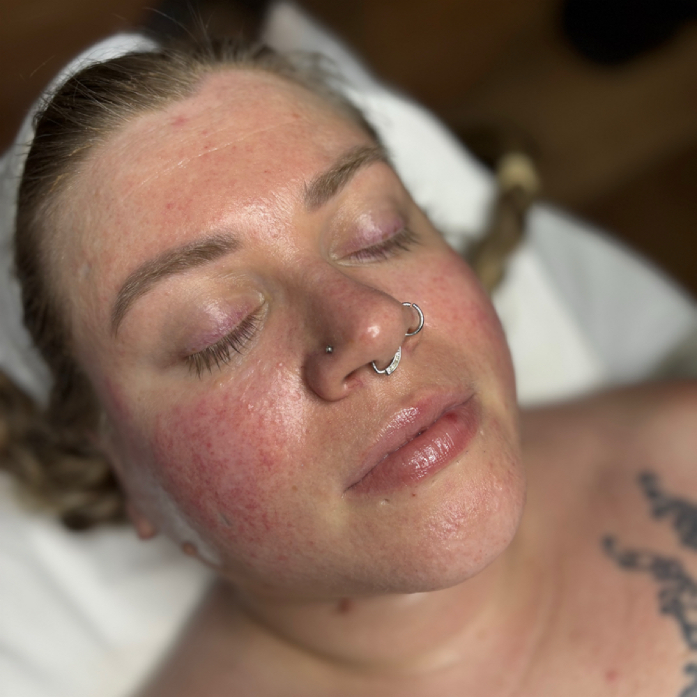 Sol Glow Facial at BelleRaye Beauty Studio LLC in West Chester Township, OH