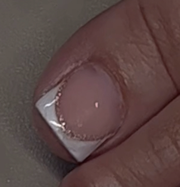 Big Toe Enhancement