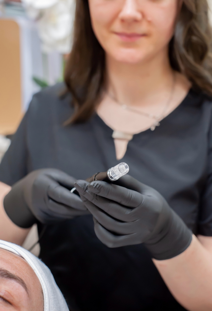 Microneedling Back