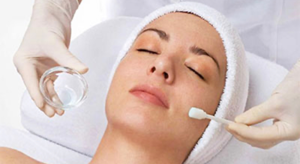 Chemical  Peel