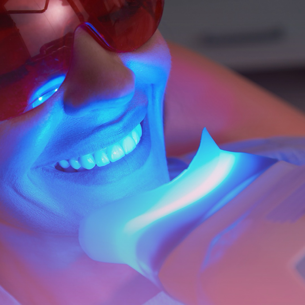 Teeth Whitening