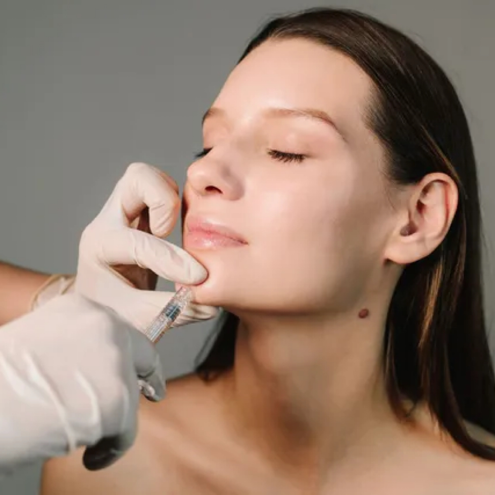 CHIN & JAWLINE FILLER at Jay Michelle Aesthetics & Wellness in Lake Jackson, TX
