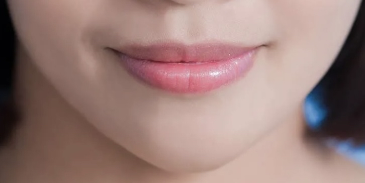 Dermal Filler-Lips