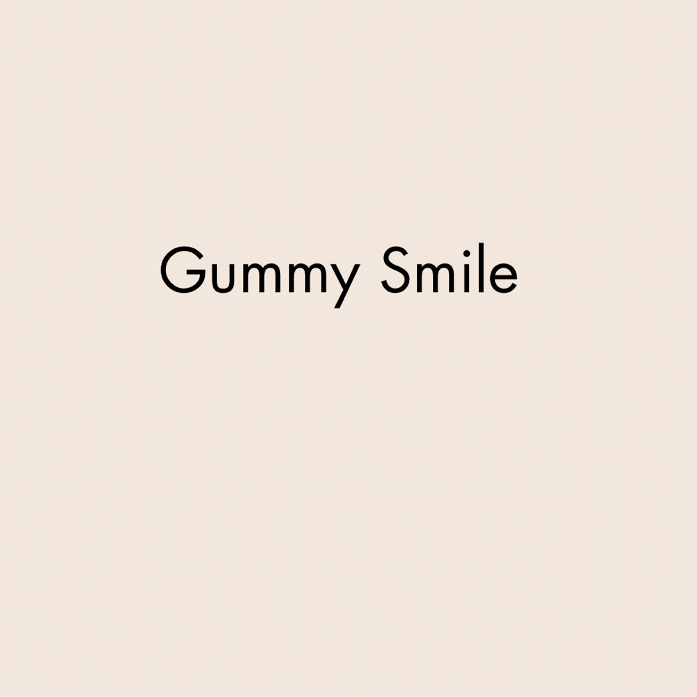 Gummy Smile (Botox)