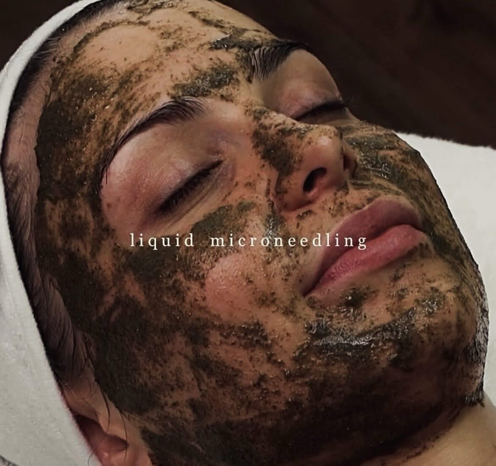 Liquid Microneedling