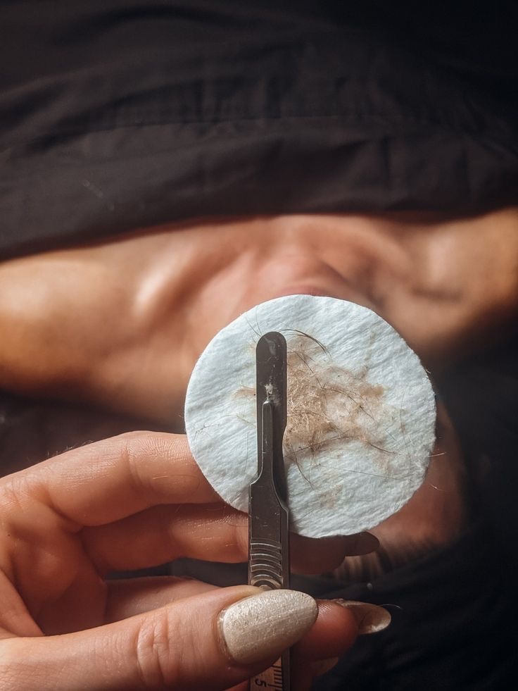 Dermaplaning