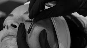 Add on: Dermaplaning