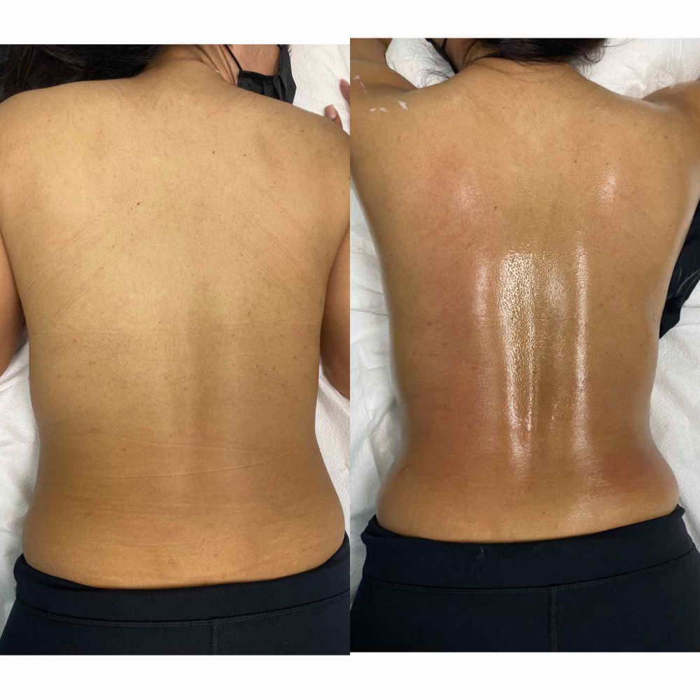 Bubbly Back Facial