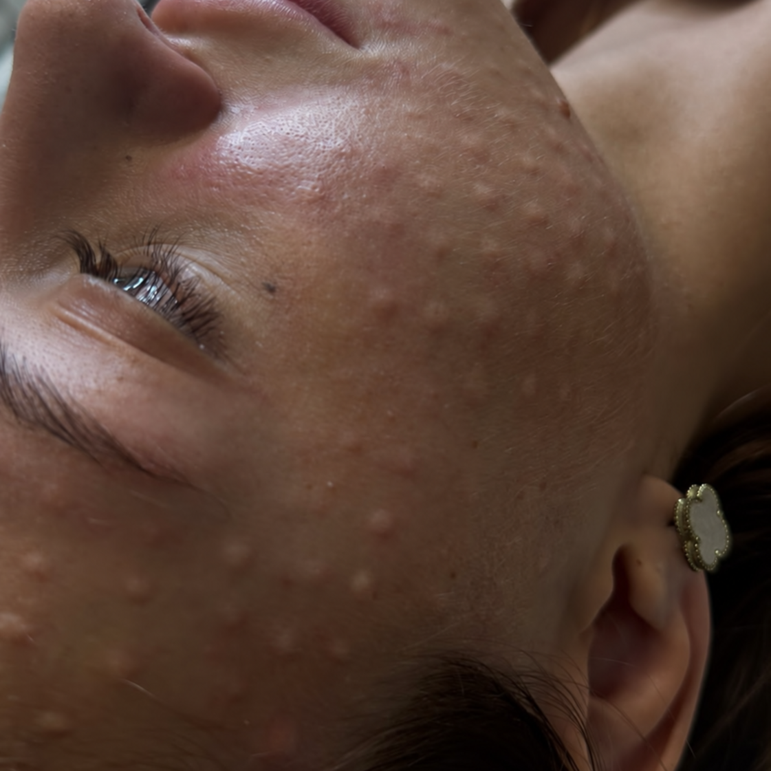 PIEL | SKIN BOOSTER at EROXSPA in Houston, TX