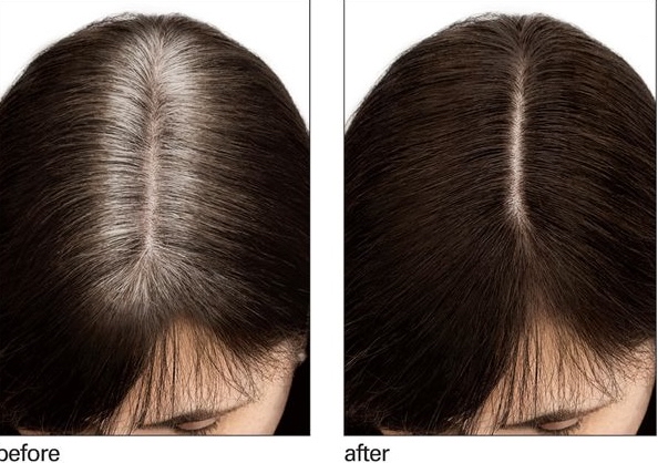 Root Touch up