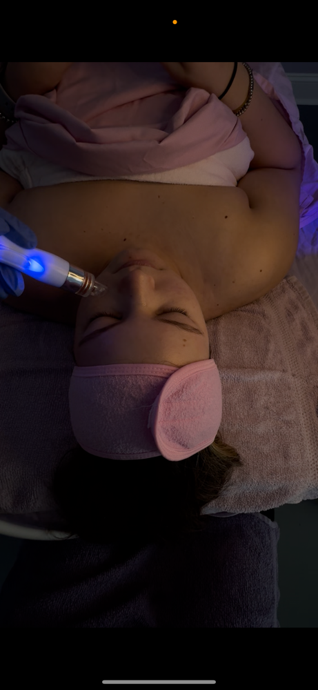HydraDerm Abrasion at KayLuxAesthetics in Fuquay-Varina, NC