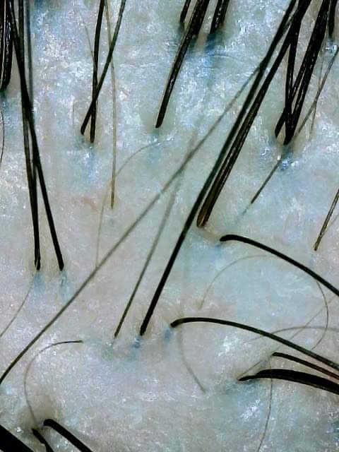 Scalp Detox