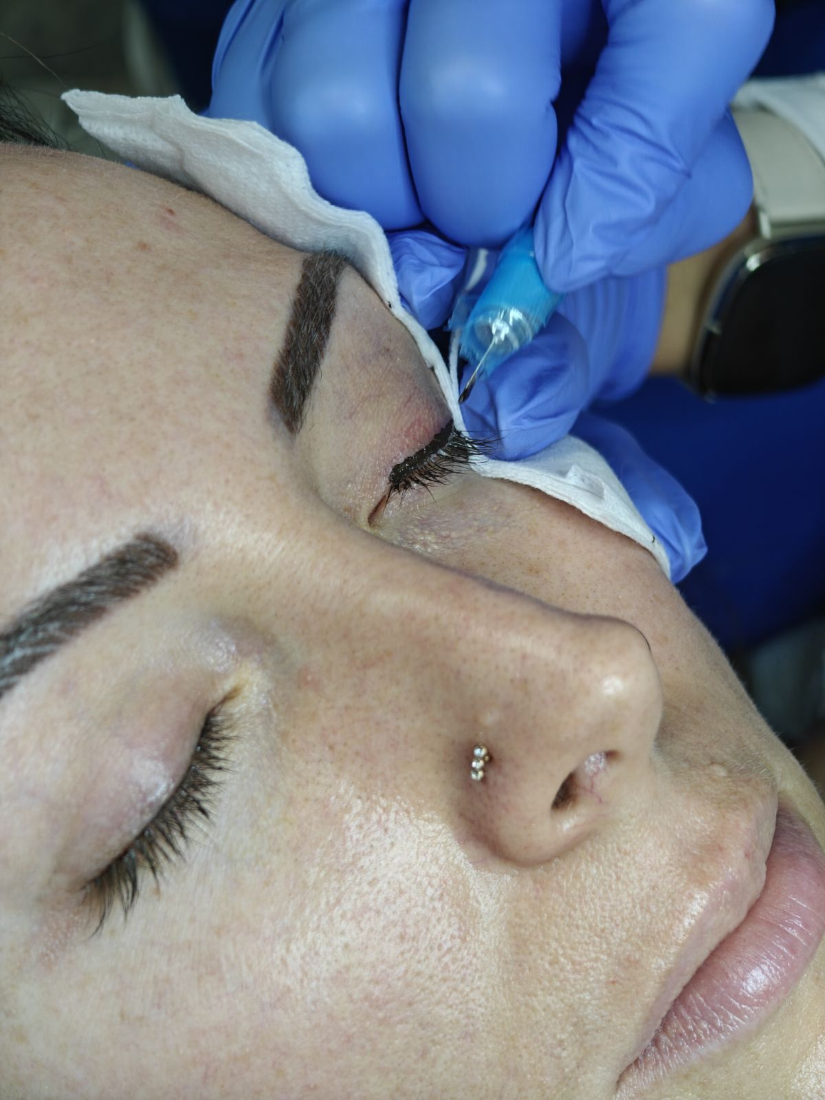 Eyelash Enhancement