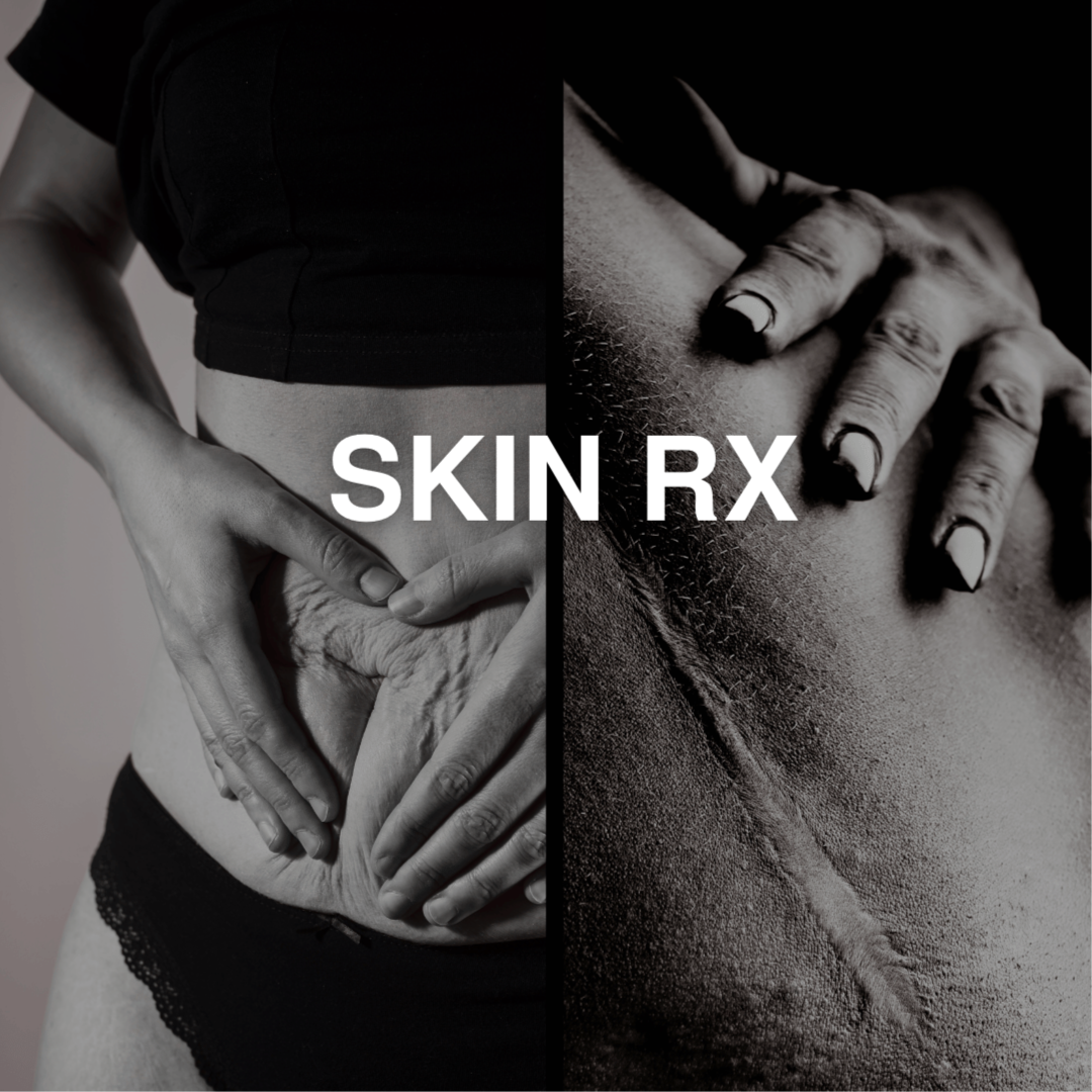 SkinRX at Tight Club | Williston in Williston, VT