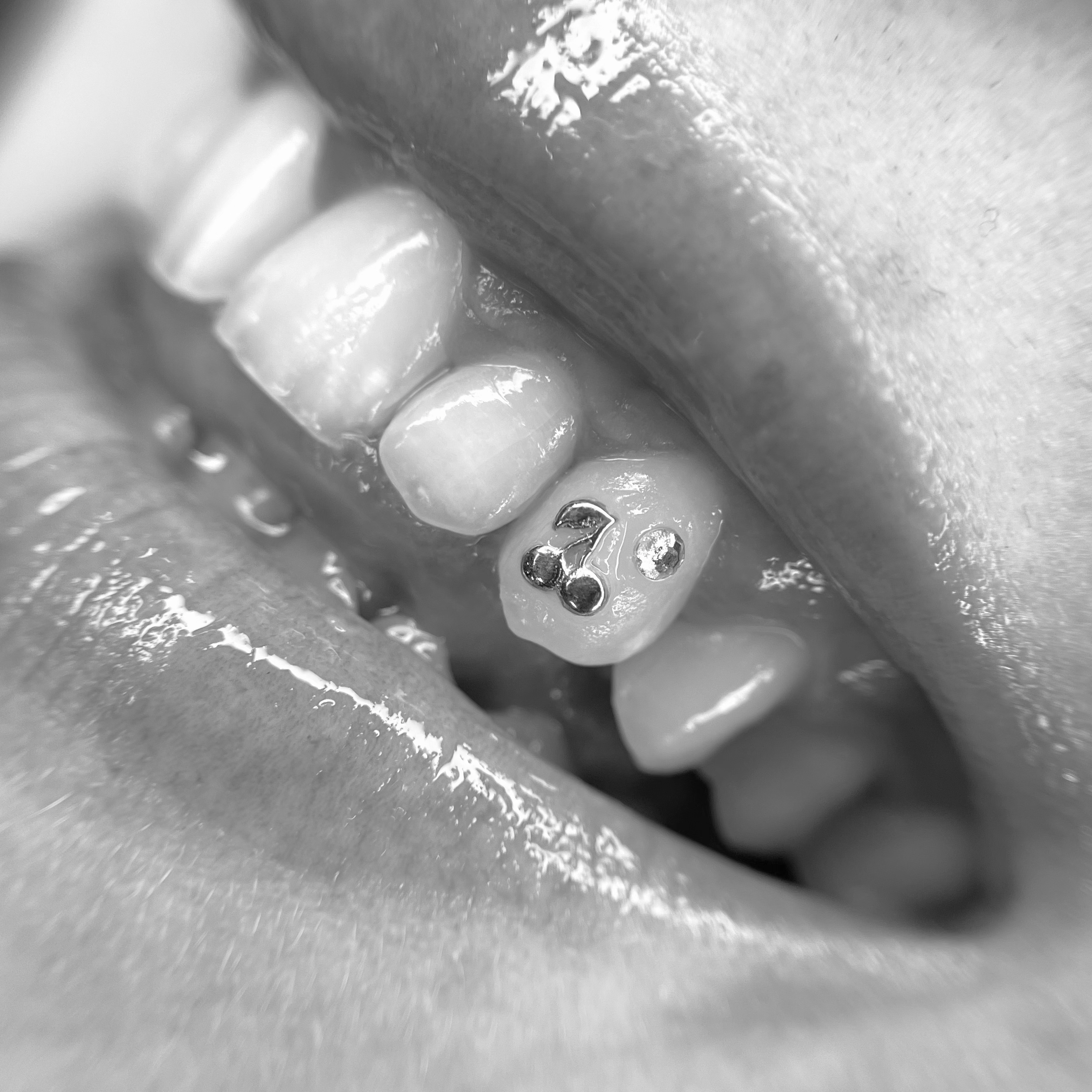 Tooth Gem: 18k Gold at The Neon Door in Tucson, AZ