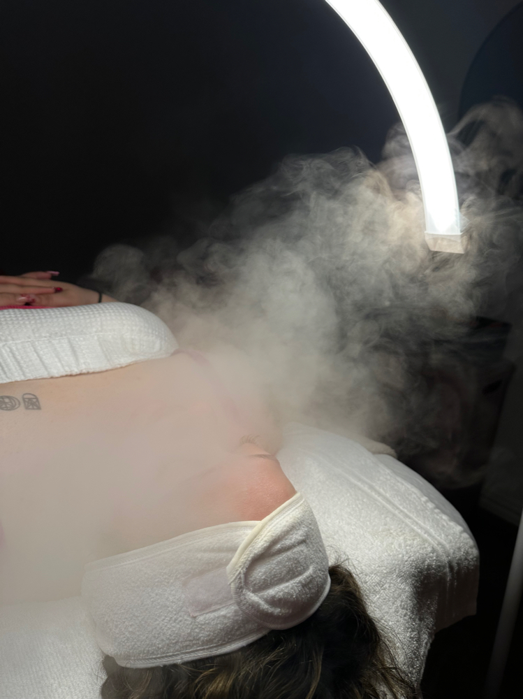 Microdermabrasion Facial