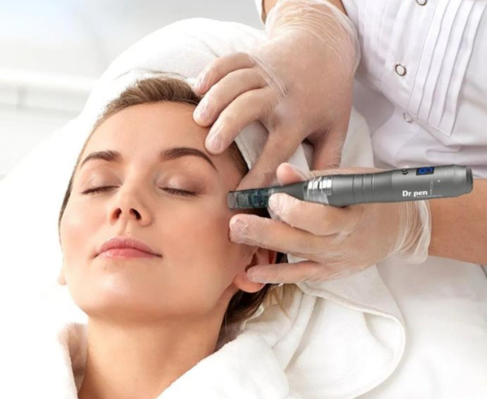 Microneedling