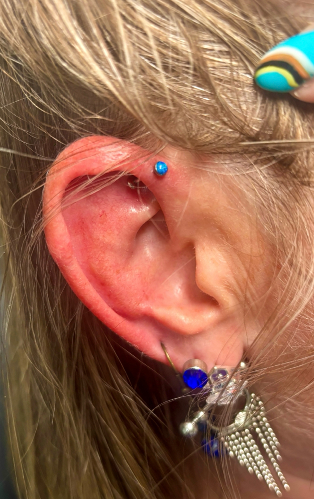 Front Helix