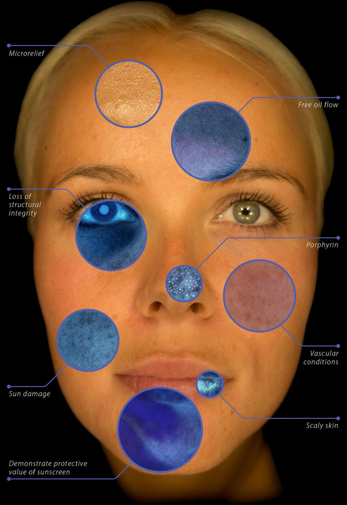 Consultation at AesthetiX in Austin, TX