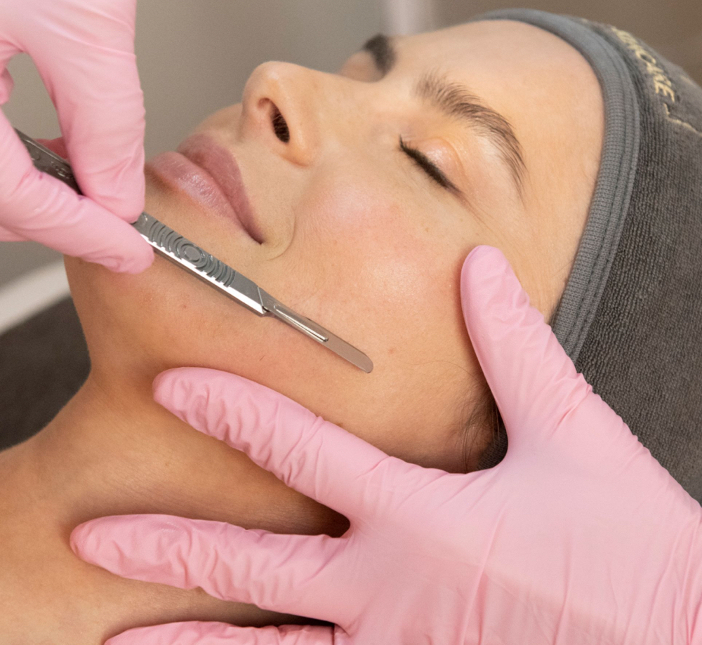 Dermaplane Facial