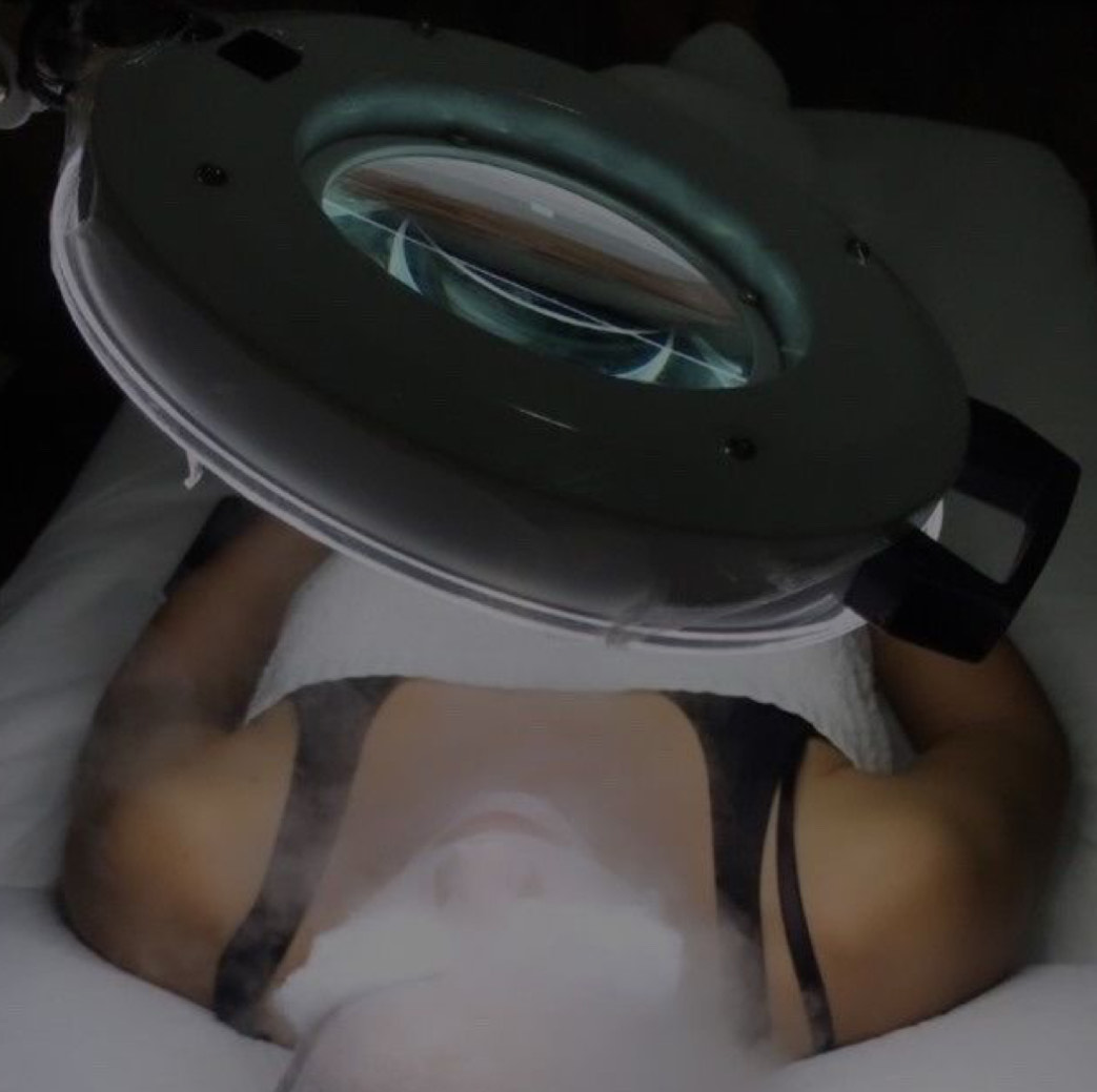 Skin Consultation