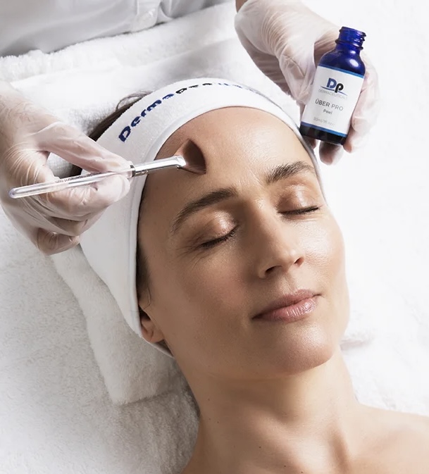 Über Pro Peel
