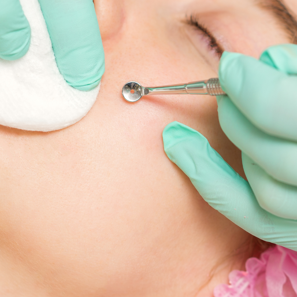 Extra Time For Extractions