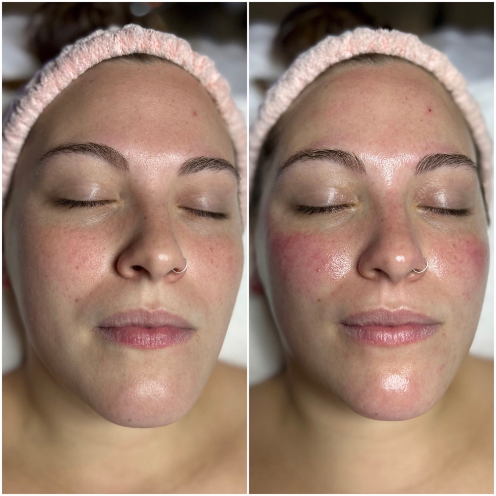 Express Facial