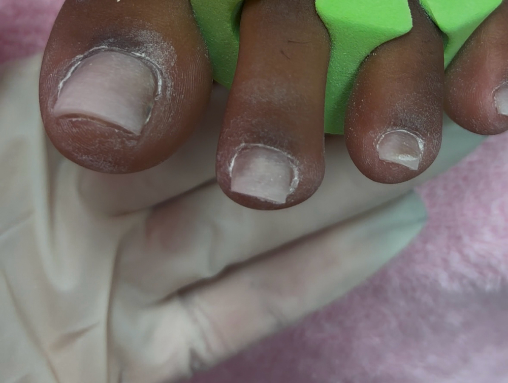 Toe BBL