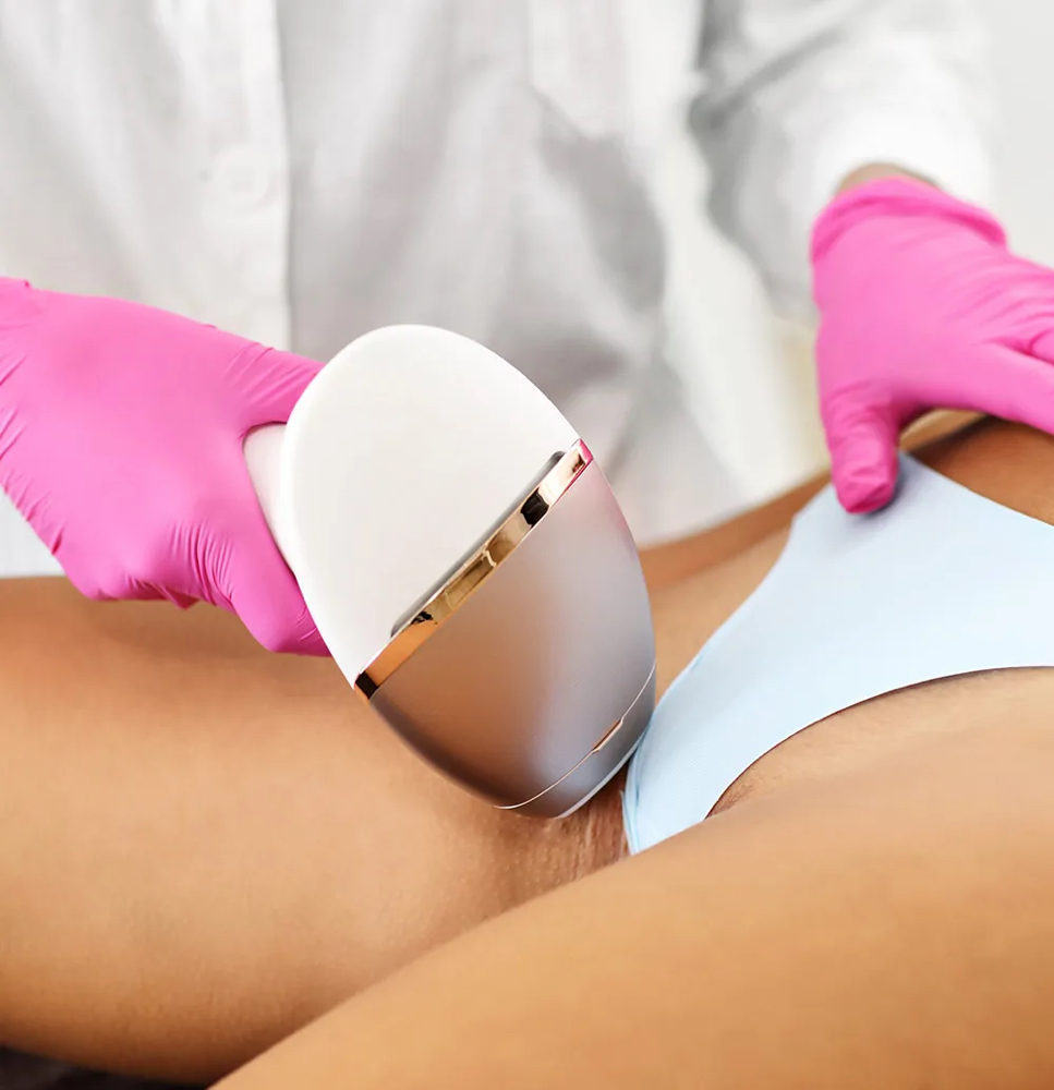 Bikini Laser Hair Removal 6S