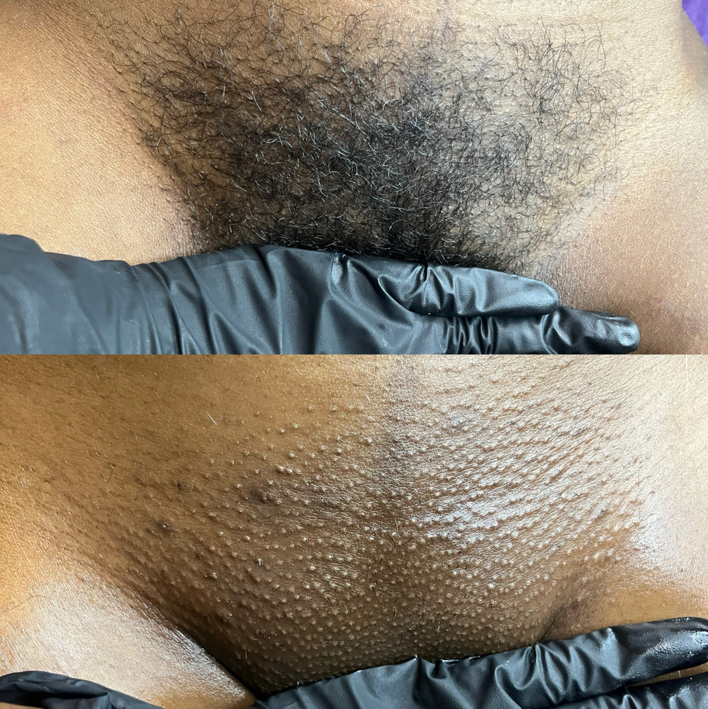 First Time Brazilian