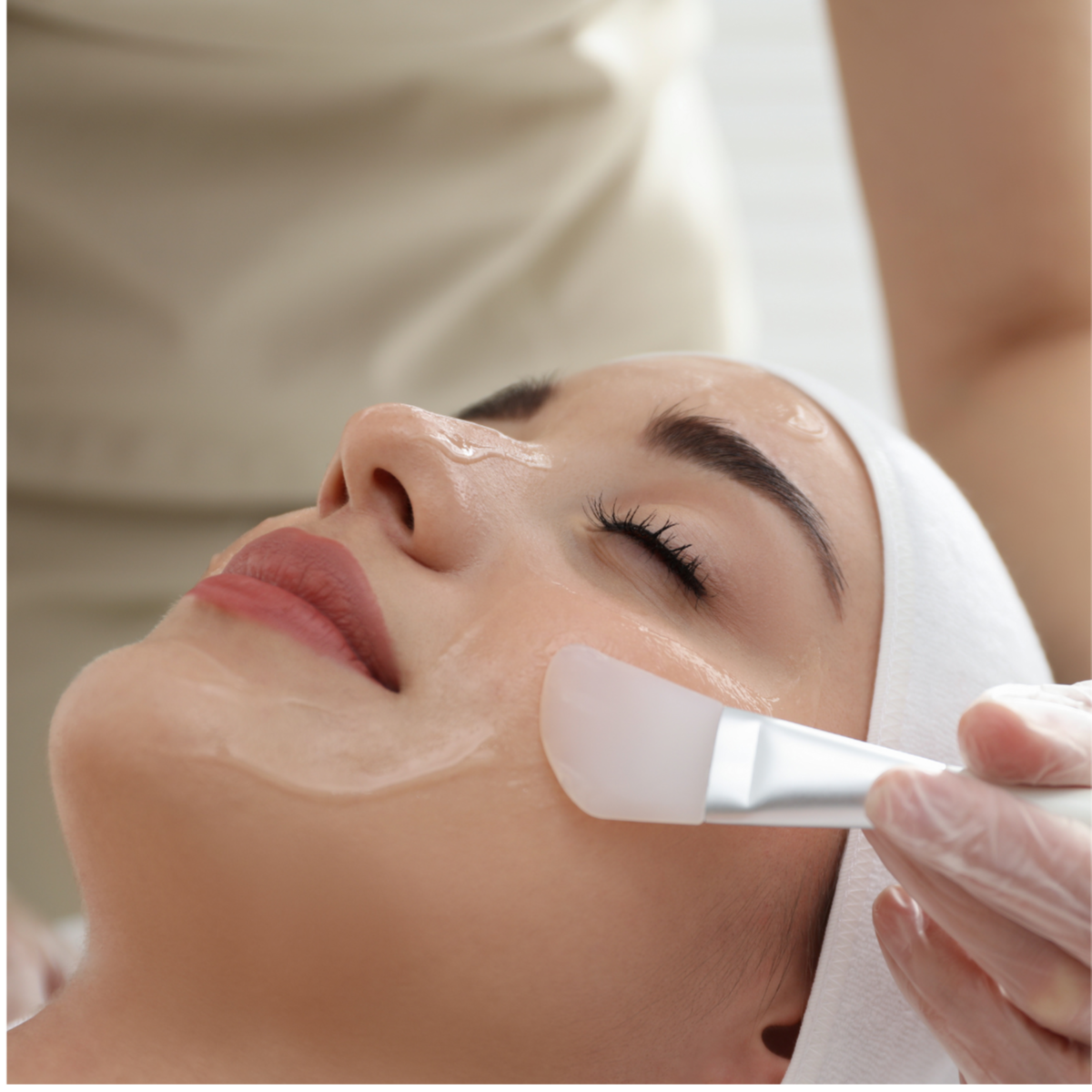 Chemical Peeling regular at Zoya Wellness Center in Rolling Meadows, IL