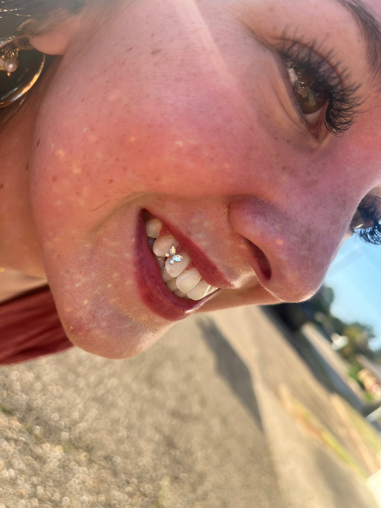 tooth gem