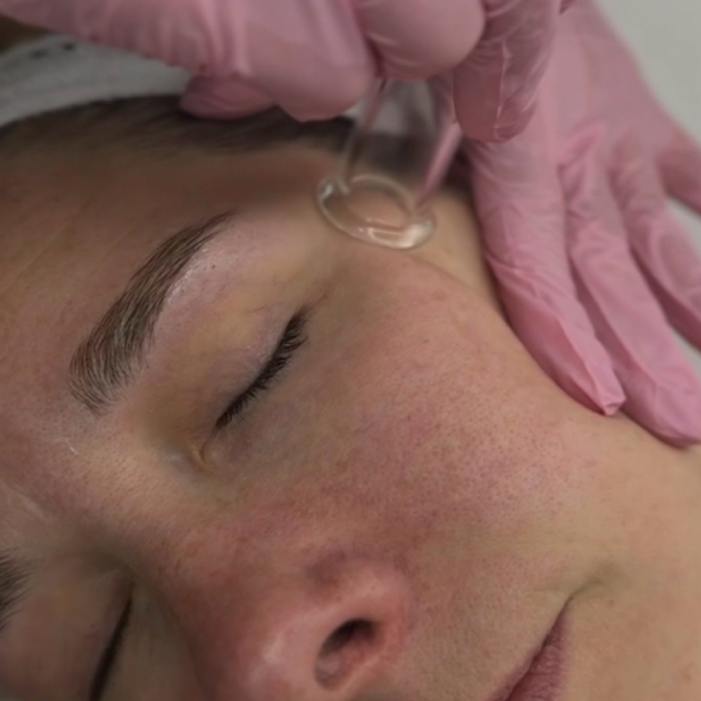 Platinum Hydrafacial