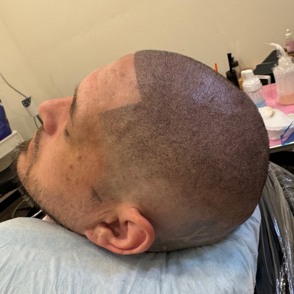 Scalp Micropigmentation at Eladia Loaiza in Sacramento, CA