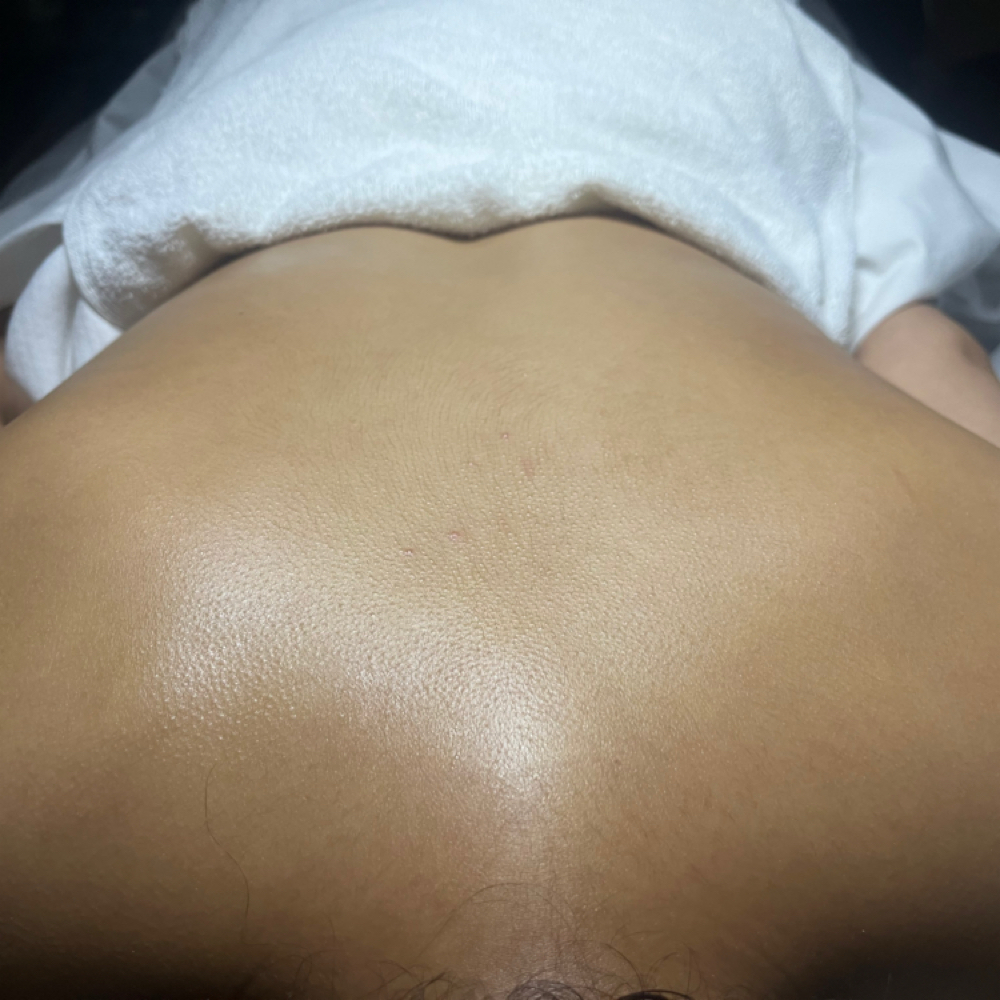 Back Essential Treatment at Cerva Beauty in Gurnee, IL