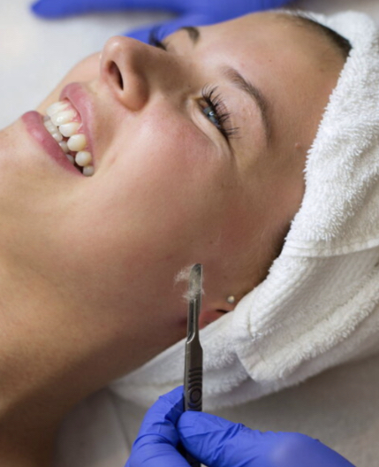 Dermaplaning (add on)