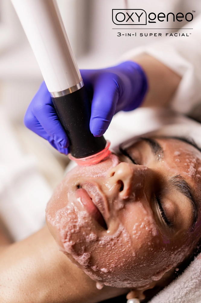 Oxygen Facial