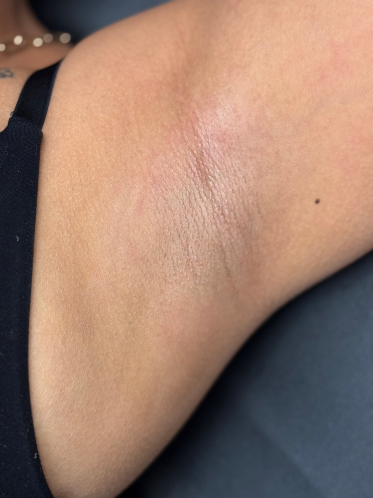 Underarm Waxing at Tesoro Luxe Aesthetics in San Antonio, TX