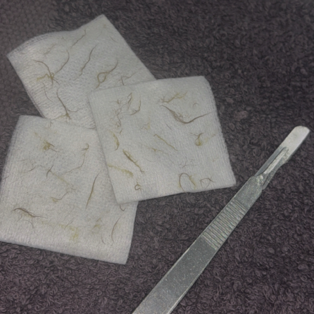 Dermaplaning Facial at Heavenly Skin Spa in Shorewood, IL