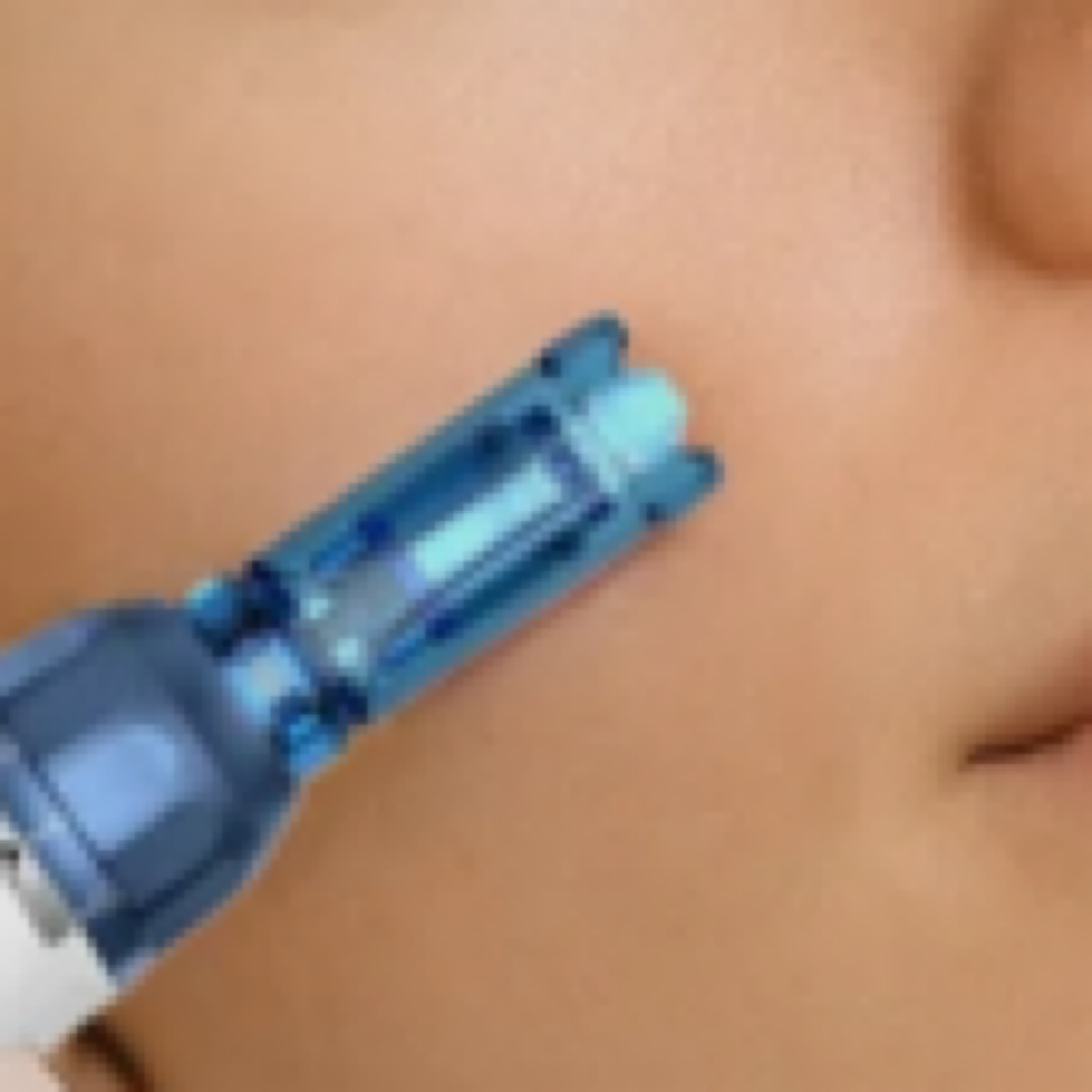 Nano-Needling Infusion Facial at Uplift Aesthetics in Union City, TN