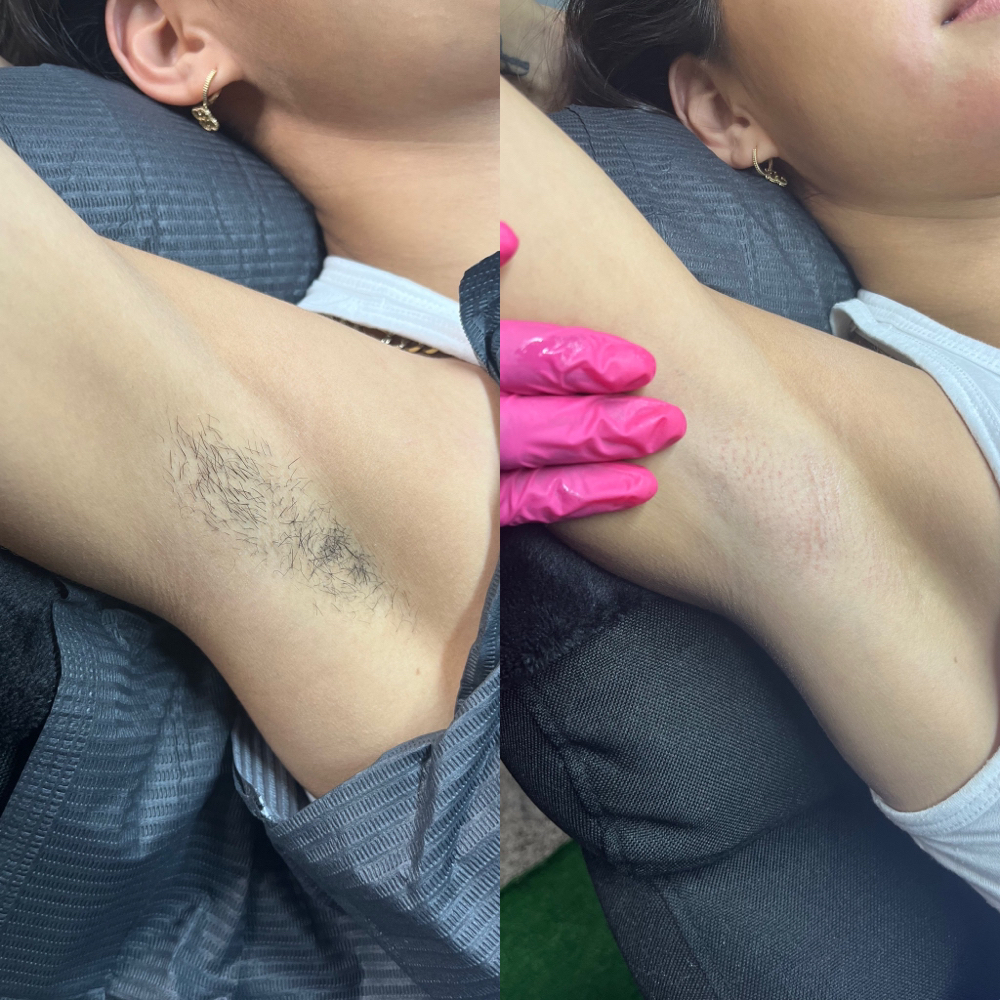 Underarm Wax